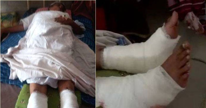 സര്‍ക്കാര്‍ ആശുപത്രിയില്‍ കാലുമാറി ശസ്ത്രക്രിയ; പരാതിയുമായി ബന്ധുക്കള്‍