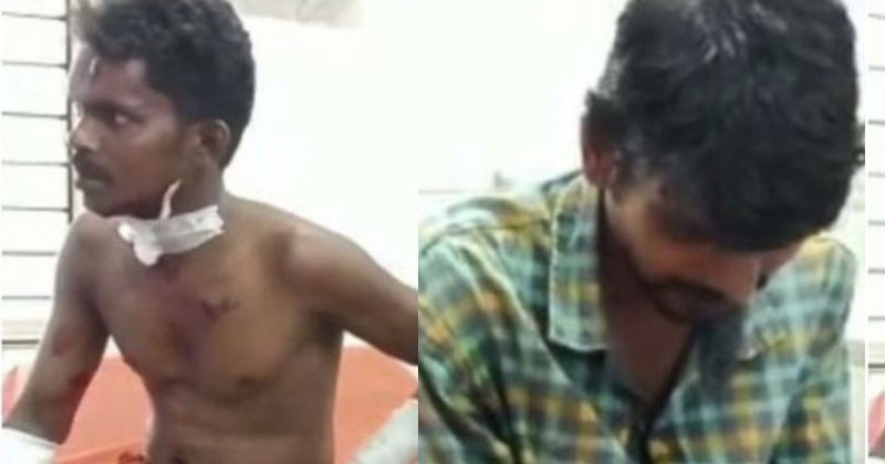 തലശ്ശേരിയില്‍ ബിജെപി ഓഫീസിന് മുന്നില്‍ പൈപ്പ് ബോംബ് പൊട്ടി; കുറ്റിക്കാട് വൃത്തിയാക്കുകയായിരുന്ന 3 പേര്‍ക്ക് പരിക്ക്