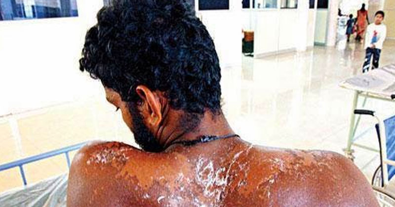 സൂക്ഷിക്കുക!!! ഇനിയുള്ള ദിവസങ്ങള്‍ പൊള്ളും; ചൂട് എട്ട് ഡിഗ്രി വര്‍ദ്ധിക്കുമെന്ന് മുന്നറിയിപ്പ്