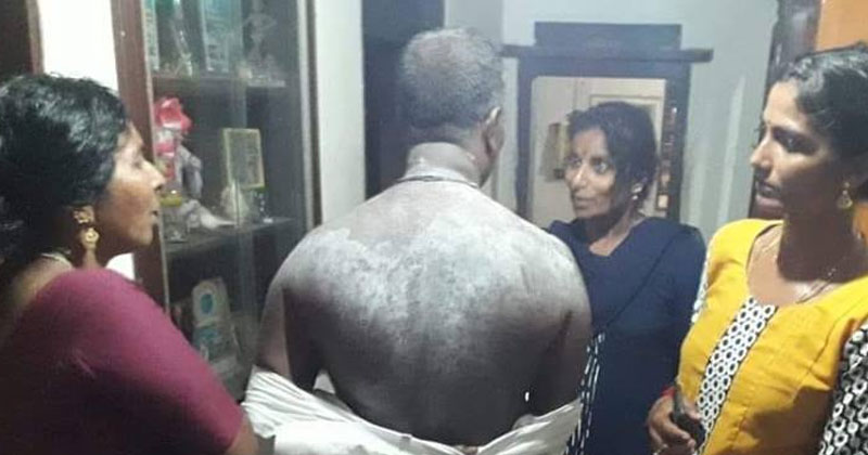 കല്യാണത്തിന് പോകാന്‍ ക്യുട്ടിക്കൂറ പൗഡര്‍ ഇട്ടിരിക്കുകയല്ല സഖാവേ, നായ്ക്കരണ പൊടിയാണ് ദേഹത്ത്; കണ്ണൂരിലെ യൂഡിഎഫിന്റെ ബൂത്ത് ഏജന്റ് വിനോദിന്റെ ചിത്രമാണിത്; സി.പി.എം പൈശാചികതയുടെ നേര്‍ക്കാഴ്ച്ച വിവരിച്ച് യുവാവിന്റെ ഫേസ്ബുക്ക് കുറിപ്പ്