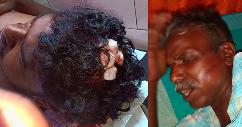 ഇടുക്കിയില്‍ കോണ്‍ഗ്രസ് പ്രവര്‍ത്തകനെ വെട്ടിക്കൊല്ലാന്‍ ശ്രമം; വീടുകയറി അക്രമണത്തില്‍ നിരവധിപേര്‍ക്ക് പരിക്ക്