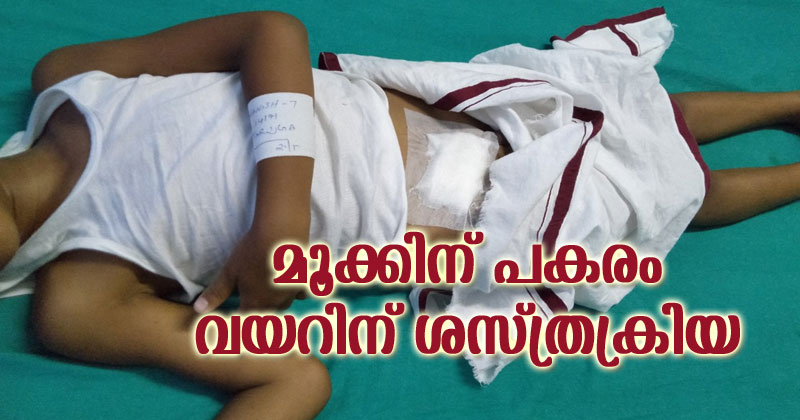 ഏഴുവയസുകാരന്‍റെ മൂക്കിന് പകരം വയറിന് ശസ്ത്രക്രിയ നടത്തി; ആളുമാറിയെന്ന് വിശദീകരണം