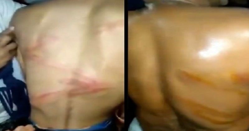ബി.ജെ.പിക്ക് വോട്ട് ചെയ്തില്ല; ദളിതരെയും യാദവരെയും തല്ലിച്ചതച്ച് ബീഹാര്‍ പോലീസ് (വീഡിയോ)