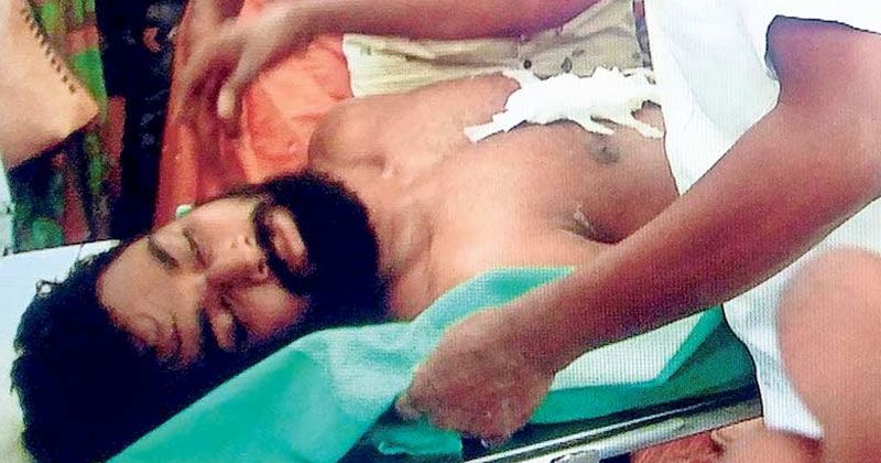 യൂണിവേഴ്‌സിറ്റി കോളേജിലെ സംഘർഷത്തിൽ എസ്എഫ്‌ഐക്കെതിരെ വ്യാപക പ്രതിഷേധം; പ്രതികളെ അറസ്റ്റ് ചെയ്യാതെ പോലീസ്