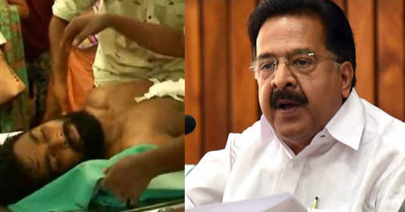 യൂണിവേഴ്‌സിറ്റി കോളേജ് സംഭവം: പുറത്തു വരുന്നത് എസ്.എഫ്.ഐയുടെ ഭീകരമുഖം; രമേശ് ചെന്നിത്തല
