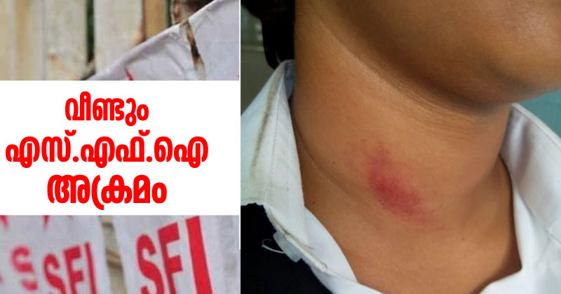 തൃശൂർ എ.ഐ.എം ലോ കോളേജില്‍ എസ്.എഫ്.ഐ അക്രമം ; കെ.എസ്.യു പ്രവര്‍ത്തകരെ മർദിച്ചു