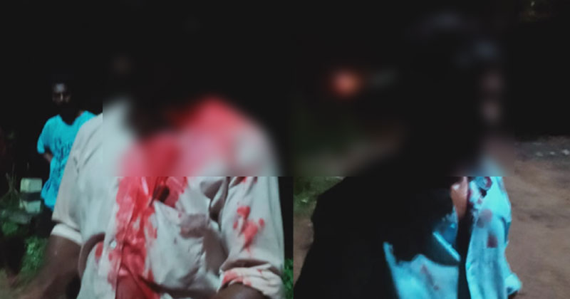 Video : വാഹനപരിശോധനയ്ക്കിടെ എസ്‌ഐയുടെ ക്രൂരമർദ്ദനം; തലയ്ക്ക് ഗുരുതര പരിക്കുമായി അഞ്ചുതെങ്ങ് സ്വദേശികളായ സെബാസ്റ്റ്യനും  ഓസ്‌കാറും