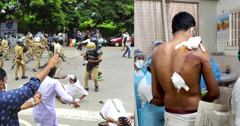യൂത്ത് കോണ്‍ഗ്രസ് മാർച്ചിനെതിരായ പൊലീസ് നരനായാട്ട് ; കർശന നടപടിയുമായി ദേശീയ മനുഷ്യാവകാശ കമ്മീഷന്‍