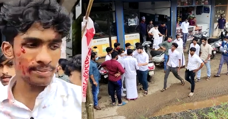 മുക്കം ഐഎച്ച്ആർഡി കോളേജിൽ റാഗിംഗിന്‍റെ പേരിൽ സംഘർഷം; 5 വിദ്യാർത്ഥികള്‍ക്ക് പരിക്ക്