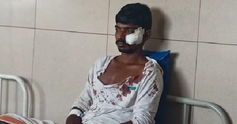 പോലീസിനെതിരെ അക്രമാസക്തനായി പ്രതി; പിടിവലിക്കിടെ മുഖത്ത് വെടിയേറ്റ് ആശുപത്രിയില്‍
