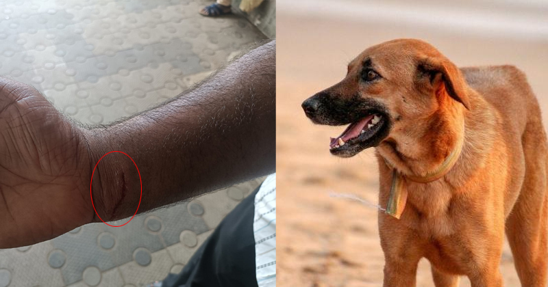 ലൈവ്സ്റ്റോക്ക് ഇന്‍സ്പെക്ടർക്ക് നായയുടെ കടിയേറ്റു;  സംഭവം വാക്സിനേഷന്‍ ക്യാമ്പിനിടെ