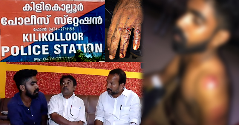 കിളികൊല്ലൂർ പോലീസ് മർദ്ദനം: മനുഷ്യാവകാശ കമ്മീഷൻ കേസെടുത്തു