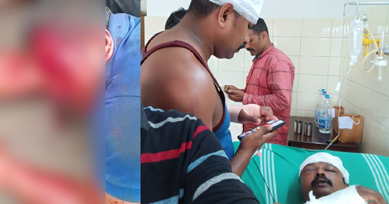 വടകരയില്‍ സിപിഎം ഗുണ്ടായിസം: സെക്യൂരിറ്റി ജീവനക്കാര്‍ക്ക് ക്രൂര മർദ്ദനം; ഗുരുതര പരിക്കുകളോടെ ആശുപത്രിയില്‍