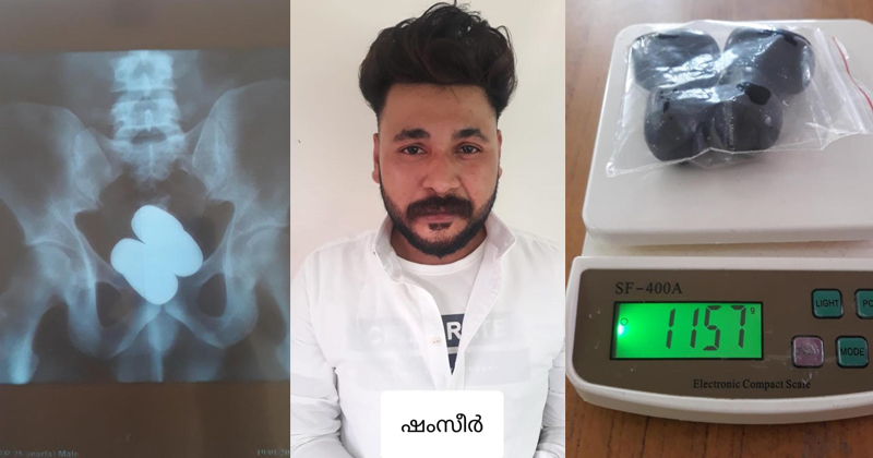 കരിപ്പൂരില്‍ 67 ലക്ഷം രൂപയുടെ സ്വർണ്ണം പിടികൂടി; വടകര സ്വദേശി അറസ്റ്റില്‍