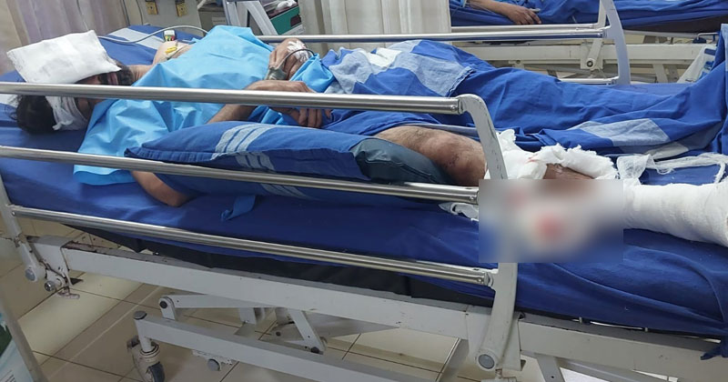 കണ്ണൂരില്‍ ആർഎസ്എസ് ആക്രമണം; കോണ്‍ഗ്രസ് പ്രവർത്തകന് ഗുരുതര പരിക്ക്