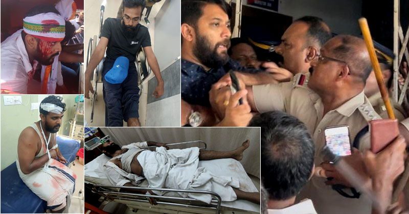 കളമശേരിയില്‍ യൂത്ത് കോണ്‍ഗ്രസ് മാർച്ചിന് നേരെ പോലീസ് തേർവാഴ്ച: പ്രവർത്തകരുടെ തലയടിച്ച് പൊട്ടിച്ചു; ഷാഫി പറമ്പില്‍ എംഎല്‍എയ്ക്ക് നേരെയും പോലീസ് കയ്യേറ്റം | VIDEO