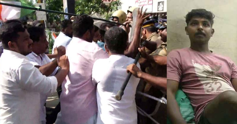 കൊച്ചി പോലീസ് മര്‍ദ്ദനം; യുവാവിന്‍റെ അമ്മ പരാതി നല്‍കി; മര്‍ദ്ദനത്തില്‍ പ്രതിഷേധിച്ച യൂത്ത് കോണ്‍ഗ്രസ് മാര്‍ച്ചില്‍ സംഘര്‍ഷം