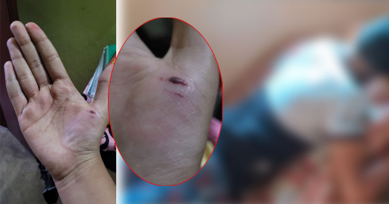 കൊല്ലത്ത് ആറാം ക്ലാസുകാരന് അധ്യാപകന്‍റെ ക്രൂര മർദ്ദനം; രക്ഷിതാക്കളുടെ പരാതിയില്‍ പോലീസ് കേസെടുത്തു