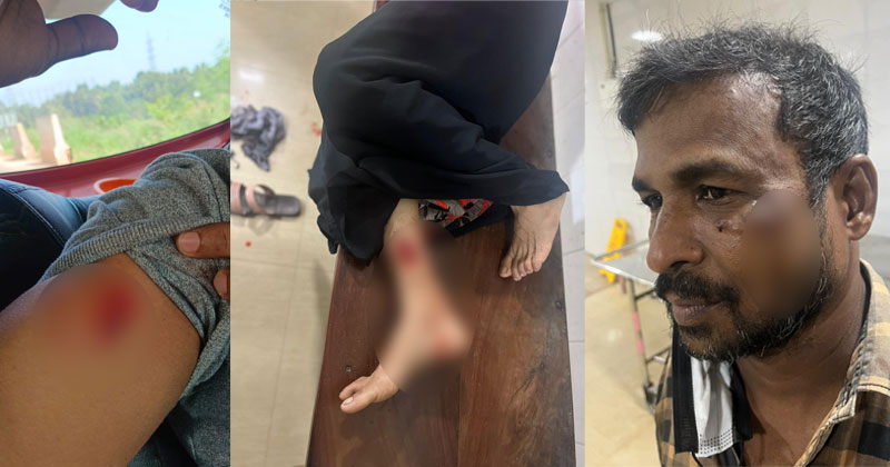 മലപ്പുറത്ത് തെരുവു നായ ആക്രമണം; പത്തു പേർക്ക് കടിയേറ്റു