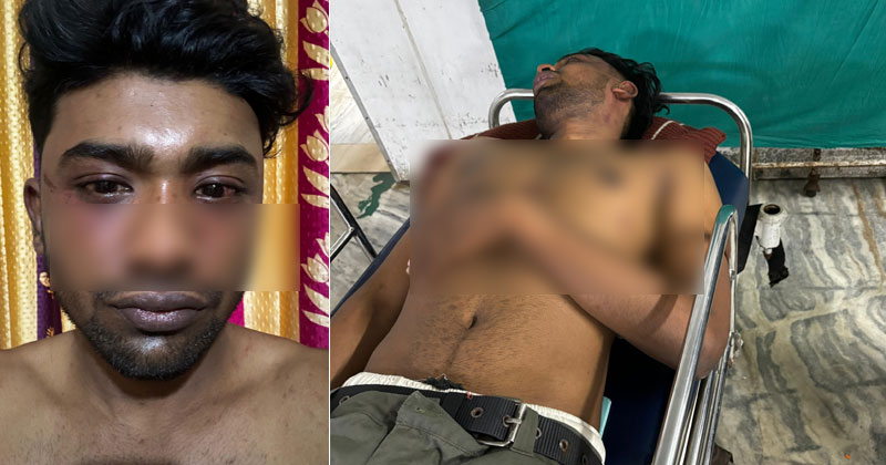 പിറന്നാള്‍ കേക്കുമായി രാത്രി പതിനാറുകാരിയെ കാണാനെത്തി; യുവാവിനെ തുണിയില്‍ തേങ്ങ കെട്ടി തല്ലി ബന്ധുക്കള്‍, പോക്സോ കേസ്