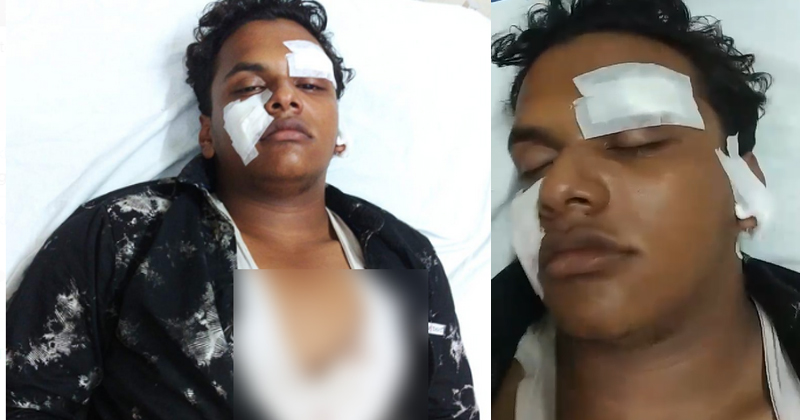 മൂലങ്കാവ് സ്കൂളില്‍ വിദ്യാർത്ഥിക്ക് ക്രൂരമർദ്ദനം; കത്രിക കൊണ്ട് കുത്തി പരുക്കേൽപ്പിച്ചു, കേസുമായി മുന്നോട്ടെന്ന് അമ്മ