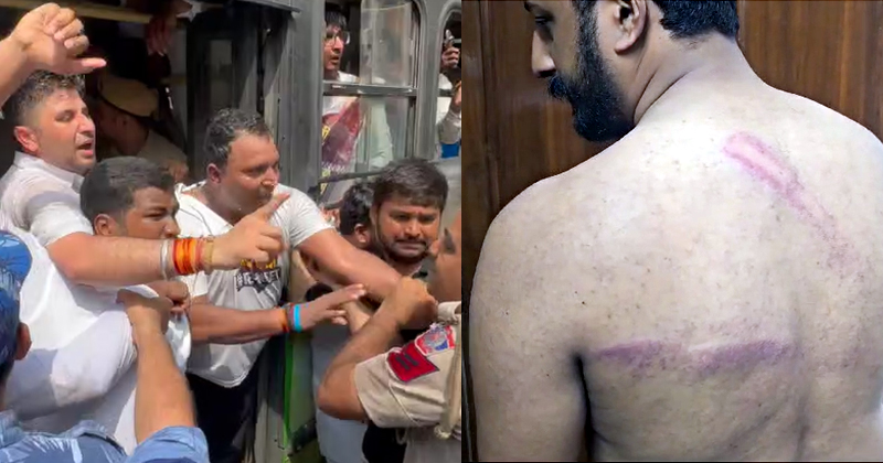നീറ്റ് ചോദ്യപേപ്പർ ചോർച്ച; ഡല്‍ഹിയിലെ യൂത്ത് കോണ്‍ഗ്രസ് പ്രതിഷേധത്തിനു നേരെ പോലീസ് ലാത്തിച്ചാർജ്; രാഹുല്‍ മാങ്കൂട്ടത്തിലിന് പരുക്ക്