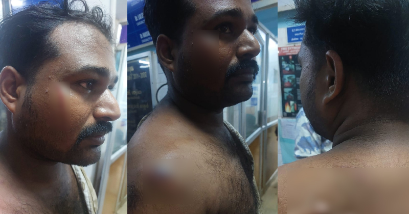 ആലപ്പുഴയില്‍ യുഡിഎഫ് ആഹ്ലാദ പ്രകടനത്തിന് നേരെ സിപിഎം അക്രമം; മൂന്ന് കോൺഗ്രസ് പ്രവർത്തകർക്ക് പരിക്ക്
