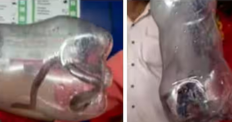 മകളുമായി സർക്കാർ ആശുപത്രിയിലെത്തിയ അമ്മയ്ക്ക് പാമ്പുകടിയേറ്റു; സംഭവം പാലക്കാട്