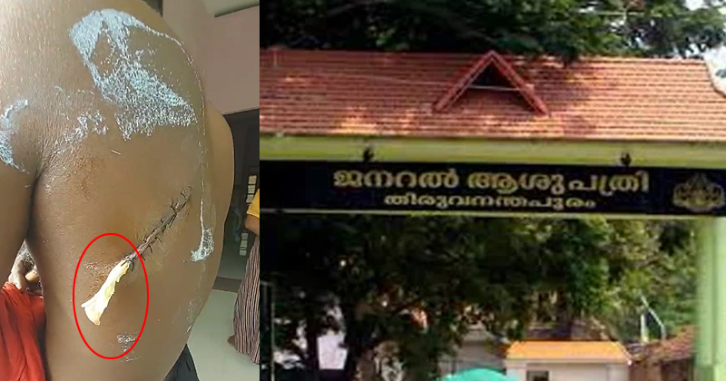 തിരുവനന്തപുരം ജനറല്‍ ആശുപത്രിയില്‍ ശസ്ത്രക്രിയക്കിടെ കയ്യുറ വെച്ച് തുന്നിക്കെട്ടിയെന്ന് പരാതി; ചികിത്സാ പിഴവ് ഉണ്ടായിട്ടില്ലെന്ന് സൂപ്രണ്ട് | VIDEO