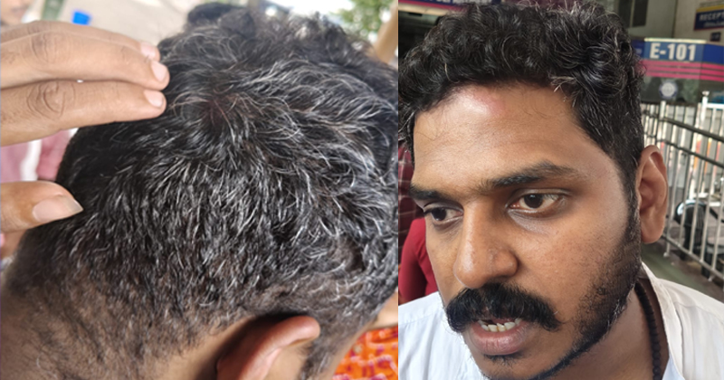എംജി സർവകലാശാല സെനറ്റ്-സ്റ്റുഡന്‍റസ് കൗൺസിൽ തിരഞ്ഞെടുപ്പില്‍ അക്രമം അഴിച്ചുവിട്ട് എസ്എഫ്ഐ; കെഎസ്‌യു സ്ഥാനാർത്ഥികള്‍ക്ക് ക്രൂര മർദ്ദനം