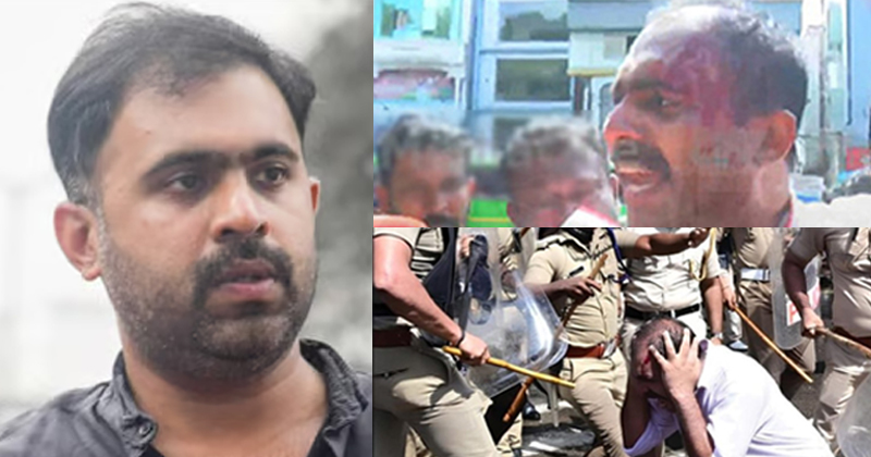 സെക്രട്ടേറിയേറ്റ് മാർച്ചിലുണ്ടായ മർദ്ദനം; കന്‍റോൺമെന്‍റ് എസ്ഐക്കെതിരെ  നിയമ നടപടികളുമായി അബിൻ വർക്കി
